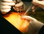 Surgery - close-up